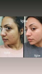 WhatsApp Image 2026-02-10 at 11.38.13 AM (1)