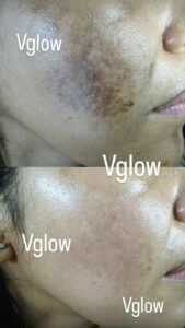 WhatsApp Image 2026-02-10 at 11.38.14 AM