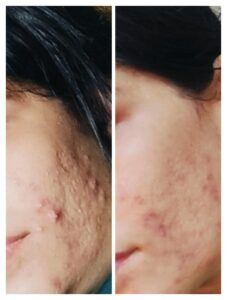 WhatsApp Image 2026-02-11 at 12.42.40 PM